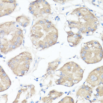 Immunohistochemistry - CLUH Polyclonal Antibody 