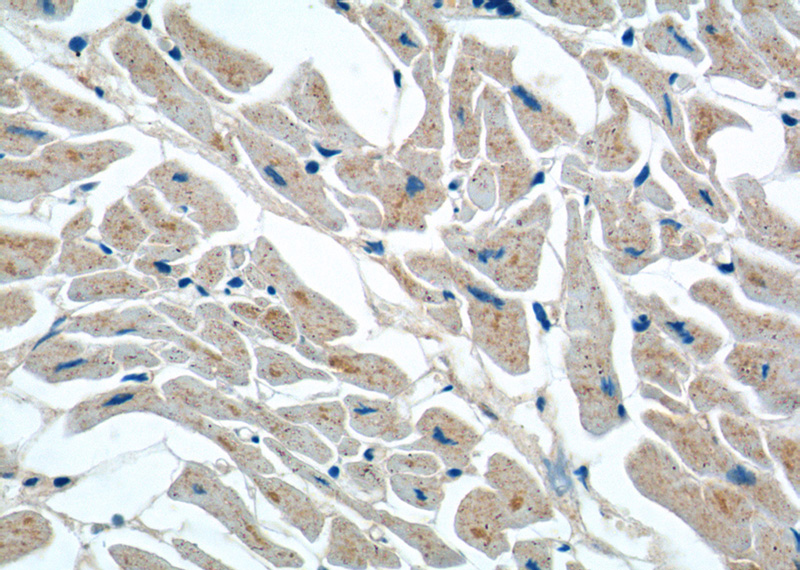 Immunohistochemistry of paraffin-embedded human heart tissue slide using Catalog No:110617(FEM1C Antibody) at dilution of 1:50 (under 40x lens)