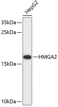 Western blot - HMGA2 Polyclonal Antibody 