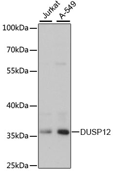 Western blot - DUSP12 Polyclonal Antibody 