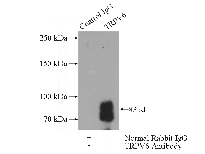 IP Result of anti-TRPV6 (IP:Catalog No:116419, 4ug; Detection:Catalog No:116419 1:300) with mouse kidney tissue lysate 4000ug.