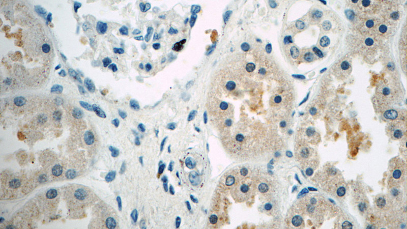 Immunohistochemistry of paraffin-embedded human kidney tissue slide using Catalog No:110565(FBXW5 Antibody) at dilution of 1:50 (under 40x lens)