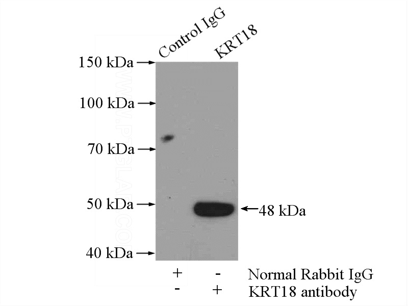 IP Result of anti-KRT18 (IP:Catalog No:109799, 4ug; Detection:Catalog No:109799 1:500) with A431 cells lysate 2000ug.