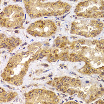 Immunohistochemistry - ANAPC5 Polyclonal Antibody 