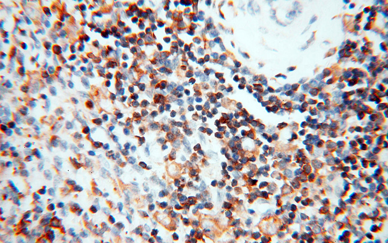 Immunohistochemical of paraffin-embedded human spleen using Catalog No:117147(BIN2 antibody) at dilution of 1:100 (under 40x lens)