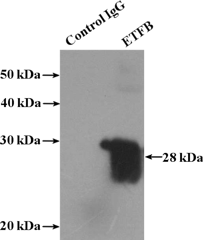 IP Result of anti-ETFB (IP:Catalog No:110484, 3ug; Detection:Catalog No:110484 1:1000) with mouse brain tissue lysate 4000ug.