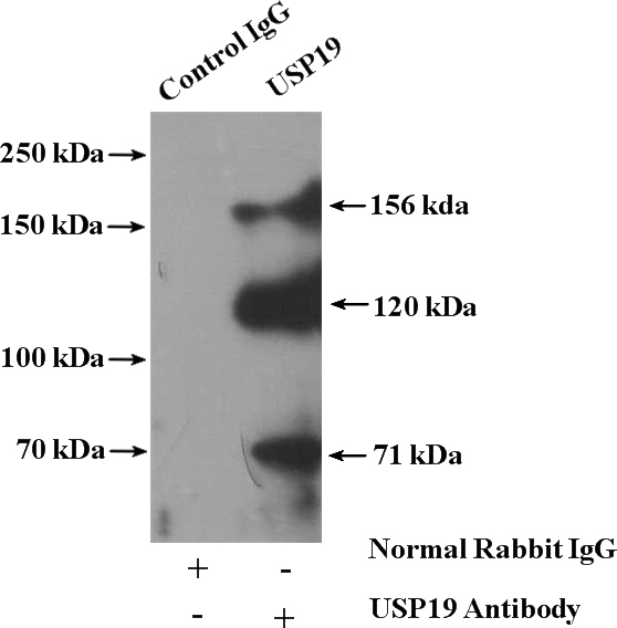 IP Result of anti-USP19 (IP:Catalog No:116595, 4ug; Detection:Catalog No:116595 1:500) with Jurkat cells lysate 2400ug.