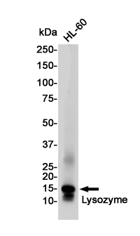 Western blot detection of Lysozyme in HL-60 cell lysates using Lysozyme Rabbit pAb(1:1000 diluted).Predicted band size:17KDa.Observed band size:17KDa.