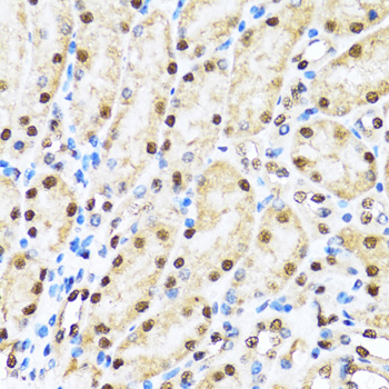 Immunohistochemistry - CCAR2 Polyclonal Antibody 
