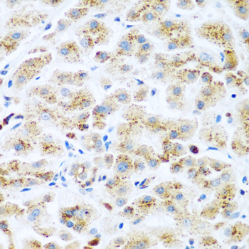 Immunohistochemistry - KIAA1456 Polyclonal Antibody 
