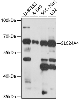 Western blot - SLC24A4 Polyclonal Antibody 