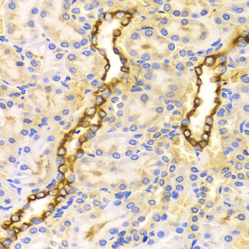 Immunohistochemistry - CPT2 Polyclonal Antibody 