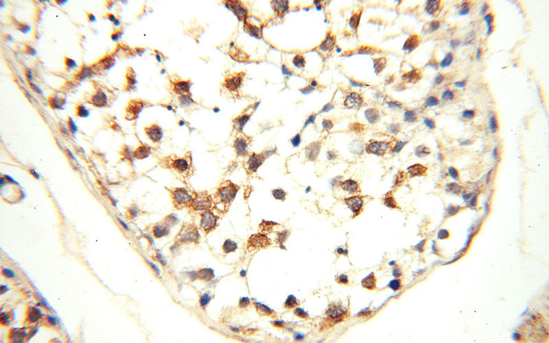 Immunohistochemical of paraffin-embedded human testis using Catalog No:115959(TEX14 antibody) at dilution of 1:50 (under 40x lens)