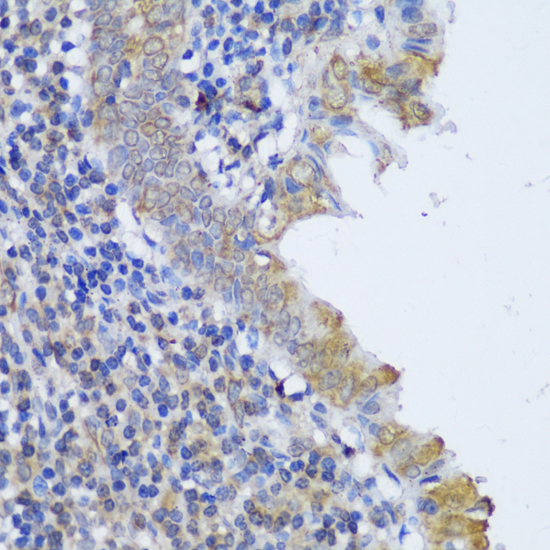 Immunohistochemistry - GCN1L1 Polyclonal Antibody 