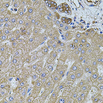 Immunohistochemistry - FLNB Polyclonal Antibody 