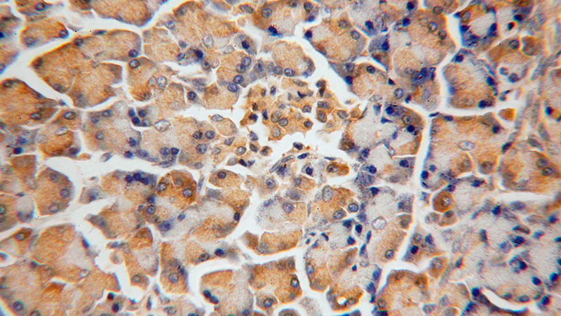 Immunohistochemical of paraffin-embedded human pancreas using Catalog No:110526(FARSB antibody) at dilution of 1:50 (under 40x lens)