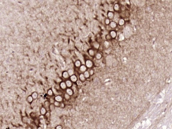 Fig4: Paraformaldehyde-fixed, paraffin embedded (Rat brain); Antigen retrieval by boiling in sodium citrate buffer (pH6.0) for 15min; Block endogenous peroxidase by 3% hydrogen peroxide for 20 minutes; Blocking buffer (normal goat serum) at 37℃ for 30min; Antibody incubation with (5HT2A Receptor) Polyclonal Antibody, Unconjugated at 1:400 overnight at 4℃, followed by operating according to SP Kit(Rabbit) (sp-0023) instructionsand DAB staining.