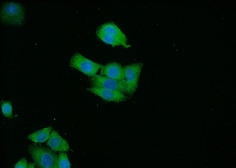 Immunofluorescent analysis of HeLa cells using Catalog No:114441(RAB3B Antibody) at dilution of 1:50 and Alexa Fluor 488-congugated AffiniPure Goat Anti-Rabbit IgG(H+L)