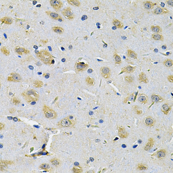 Immunohistochemistry - RRAGC Polyclonal Antibody 