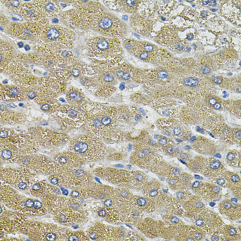 Immunohistochemistry - AQP5 Polyclonal Antibody 