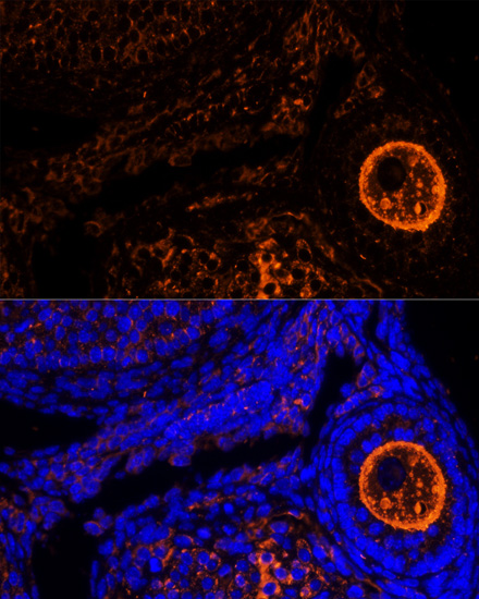 Immunofluorescence - ZP2 Polyclonal Antibody 