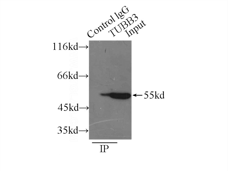 IP Result of anti-tubulin-beta (IP:Catalog No:117307, 3ug; Detection:Catalog No:117307 1:1000) with mouse brain tissue lysate 7500ug.