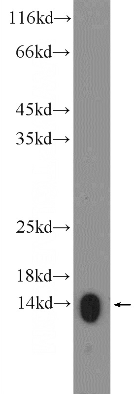 L02 cells were subjected to SDS PAGE followed by western blot with Catalog No:111363(HIST2H2AA4 Antibody) at dilution of 1:600