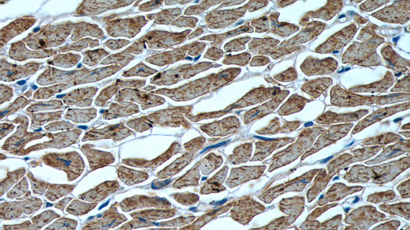 Immunohistochemistry of paraffin-embedded human heart tissue slide using Catalog No:112995(MYL2 Antibody) at dilution of 1:200 (under 40x lens)