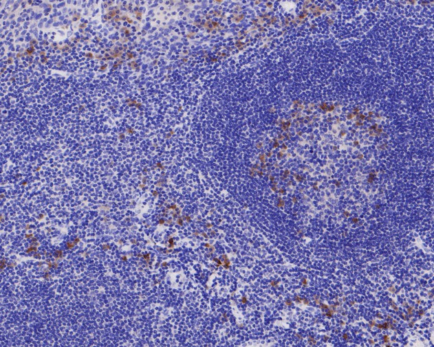 Fig2:; Immunohistochemical analysis of paraffin-embedded human tonsil tissue using anti-YKL-40/CHI3L1 antibody. The section was pre-treated using heat mediated antigen retrieval with Tris-EDTA buffer (pH 8.0-8.4) for 20 minutes.The tissues were blocked in 5% BSA for 30 minutes at room temperature, washed with ddH; 2; O and PBS, and then probed with the primary antibody ( 1/400) for 30 minutes at room temperature. The detection was performed using an HRP conjugated compact polymer system. DAB was used as the chromogen. Tissues were counterstained with hematoxylin and mounted with DPX.