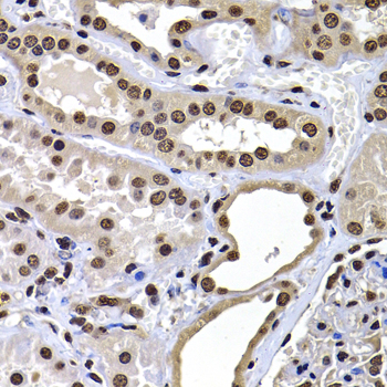 Immunohistochemistry - mH2A1 Polyclonal Antibody 