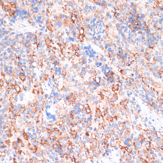Immunohistochemistry - ACAT1 Polyclonal Antibody 