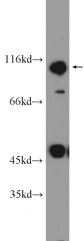DMSO treated HeLa cells were subjected to SDS PAGE followed by western blot with Catalog No:113277(NRF2, NFE2L2 Antibody) at dilution of 1:600