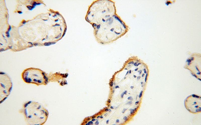 Immunohistochemical of paraffin-embedded human placenta using Catalog No:116331(CD71 antibody) at dilution of 1:100 (under 40x lens)