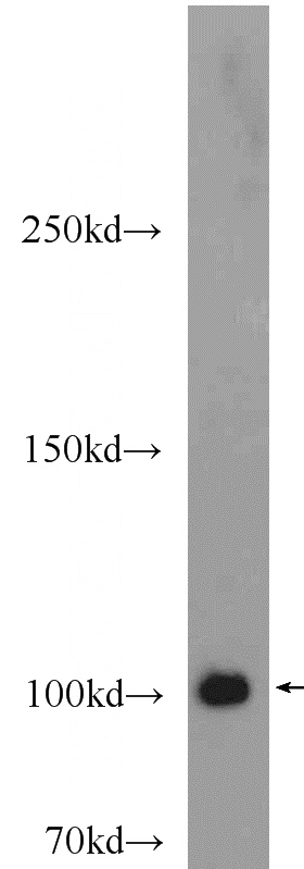 mouse brain tissue were subjected to SDS PAGE followed by western blot with Catalog No:113477(PACS2-Specific antibody) at dilution of 1:600