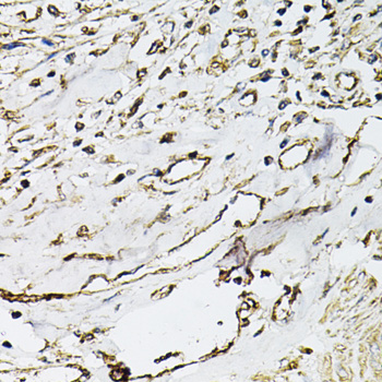 Immunohistochemistry - CD31 Polyclonal Antibody 