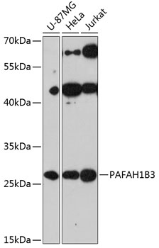 Western blot - PAFAH1B3 Polyclonal Antibody 
