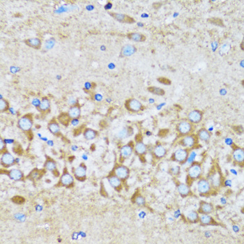 Immunohistochemistry - ACTR2 Polyclonal Antibody 
