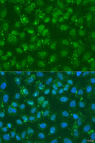 Immunofluorescence - DGKE Polyclonal Antibody 
