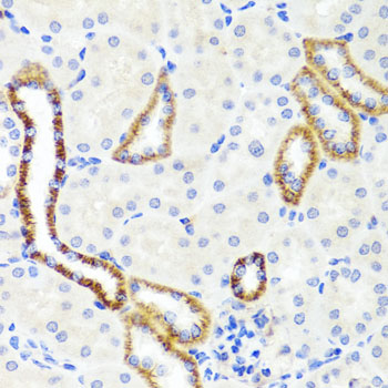 Immunohistochemistry - SYNPO Polyclonal Antibody 