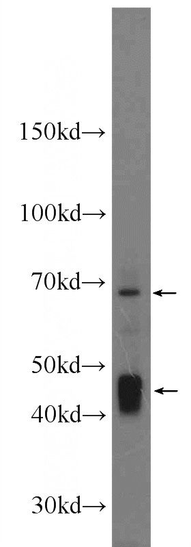 HeLa cells were subjected to SDS PAGE followed by western blot with Catalog No:114346(nectin 4 antibody) at dilution of 1:1000