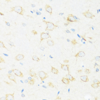 Immunohistochemistry - ASIC4 Polyclonal Antibody 