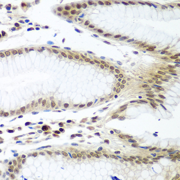 Immunohistochemistry - PTTG1 Polyclonal Antibody 