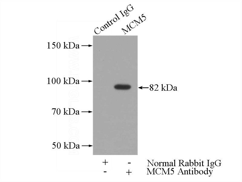IP Result of anti-MCM5 (IP:Catalog No:112555, 4ug; Detection:Catalog No:112555 1:500) with Jurkat cells lysate 2400ug.