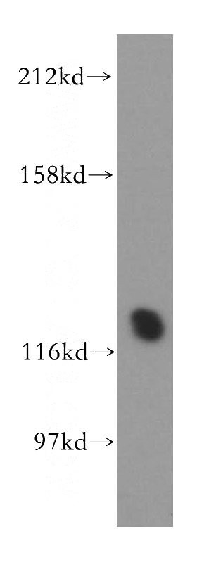 mouse heart tissue were subjected to SDS PAGE followed by western blot with Catalog No:113820(PHKB antibody) at dilution of 1:1000