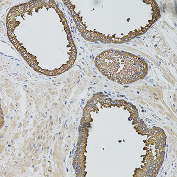 Immunohistochemistry - CASP12 Polyclonal Antibody 