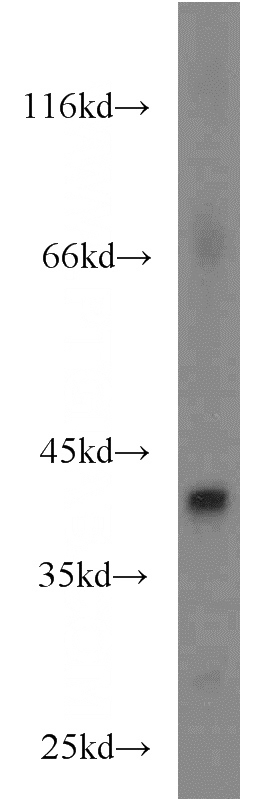 human brain tissue were subjected to SDS PAGE followed by western blot with Catalog No:110521(FANCL antibody) at dilution of 1:300