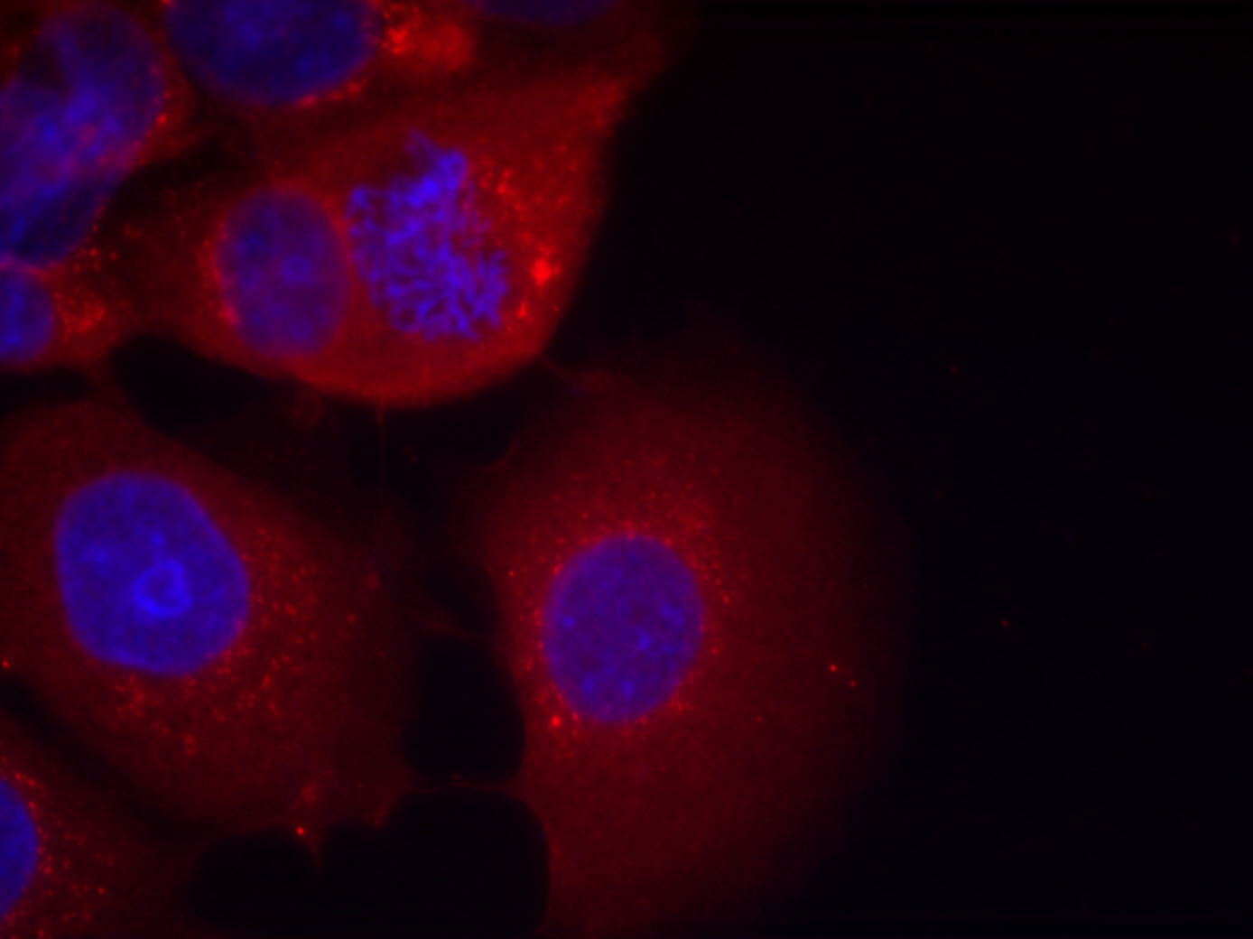 Immunofluorescence staining of methanol-fixed MCF7 cells using GSK3u03b1 (Ab-21) Antibody .