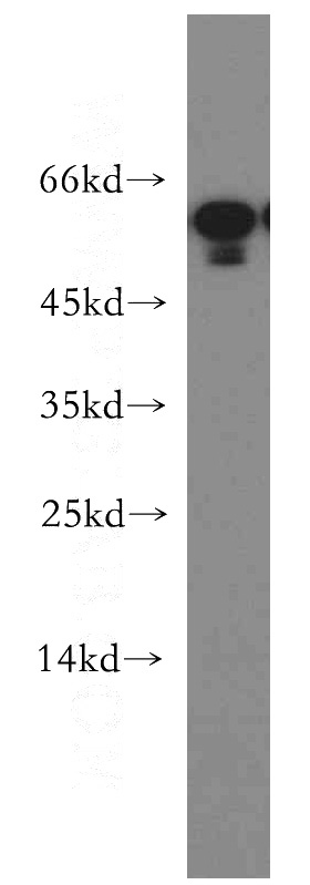 mouse small intestine tissue were subjected to SDS PAGE followed by western blot with Catalog No:116060(TINAG-Specific antibody) at dilution of 1:500