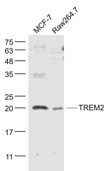 Fig4: Sample:; MCF-7(Human) Cell Lysate at 30 ug; Raw264.7(Mouse) Cell Lysate at 30 ug; Primary: Anti- TREM2 at 1/1000 dilution; Secondary: IRDye800CW Goat Anti-Rabbit IgG at 1/20000 dilution; Predicted band size: 23 kD; Observed band size: 20 kD