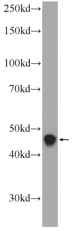 HepG2 cells were subjected to SDS PAGE followed by western blot with Catalog No:112153(LASS2 Antibody) at dilution of 1:300